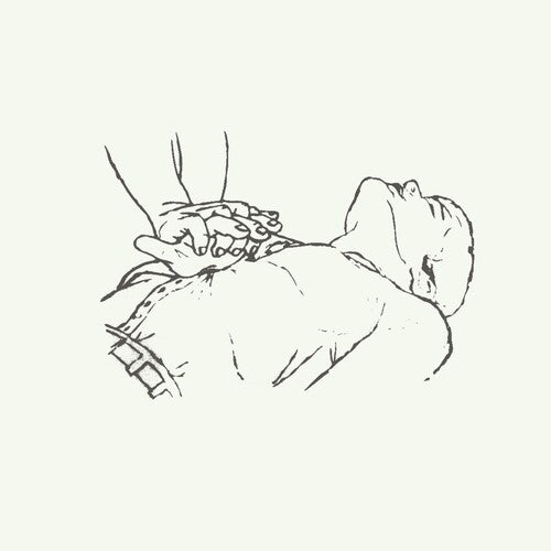 Copeland - Bajo el árbol medicinal (Vinilo)