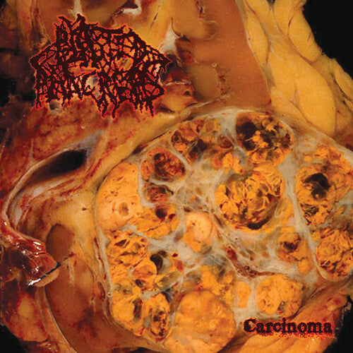 Blasted Pancreas - Carcinoma (Vinyl)