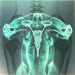 Eartheater - Shark Brain / Dolphin - Glow in the Dark (Vinyl)